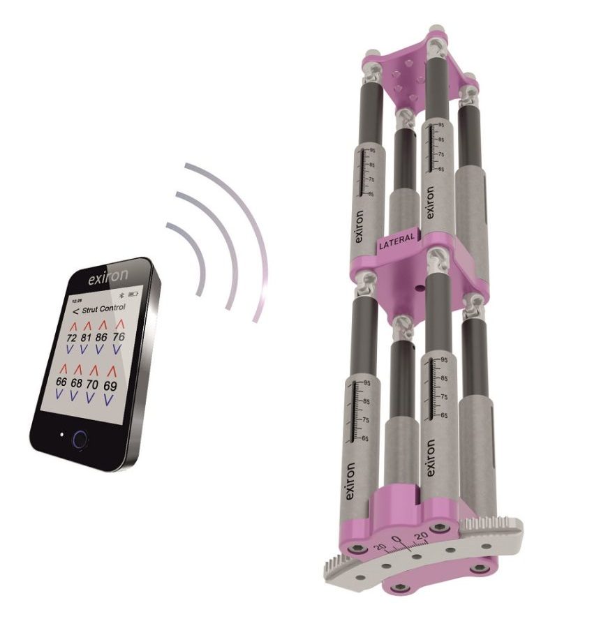 Robotic Mono-Lateral External Fixator