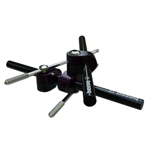 Pompac External Fixator